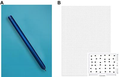 A study of auxiliary screening for Alzheimer’s disease based on handwriting characteristics